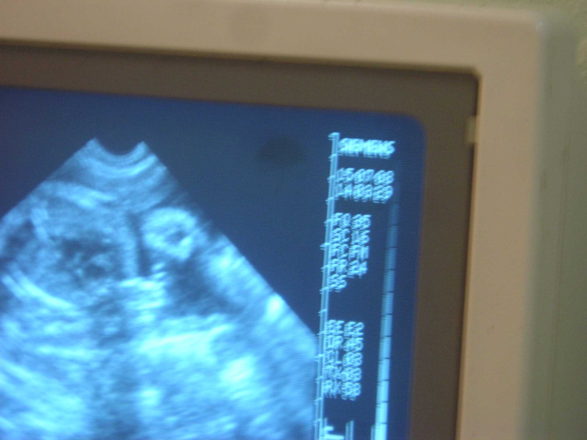 08  7 15  Baby US10  P7150160